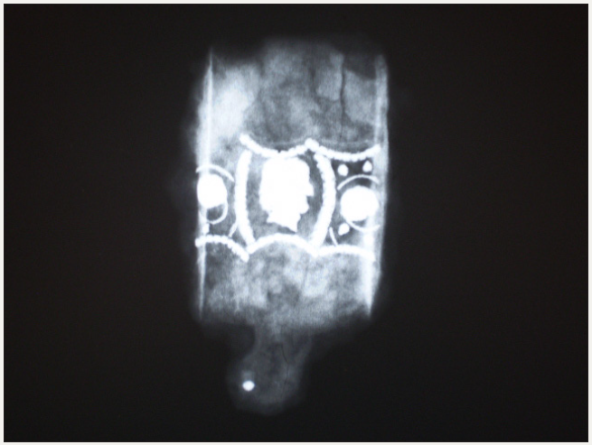 Click here to view Large image 5