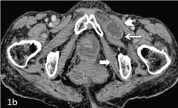 Click here to view Large Figure 1b