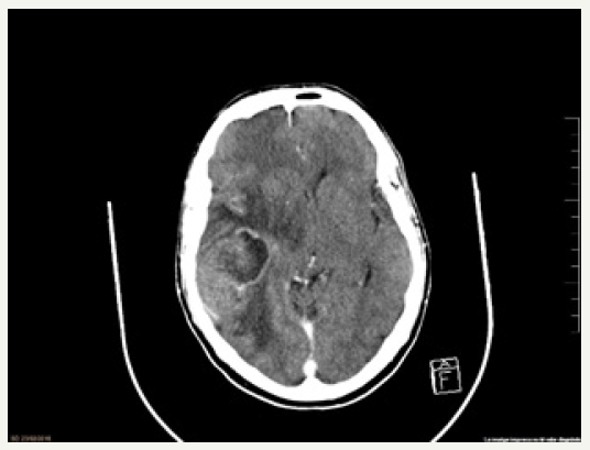 Click here to view Large image 1