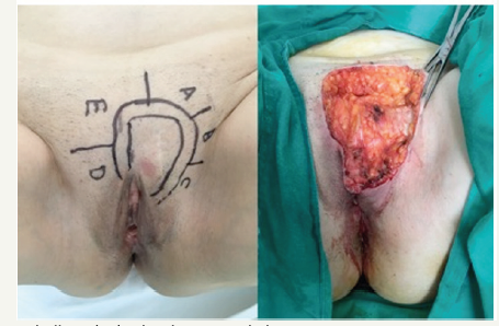 Click here to view Large image 1