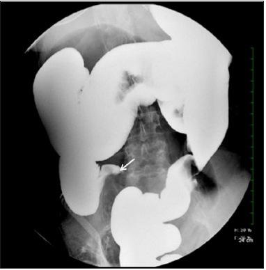 Click here to view Large image 2