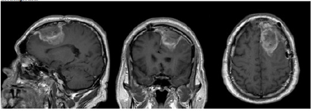 Click here to view Large image 2