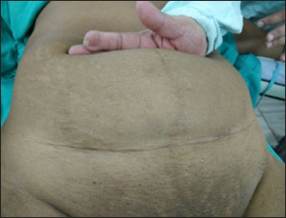 Click here to view Large Figure 1