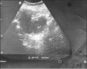 Click here to view Large Figure 2