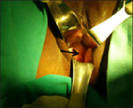 Click here to view Large Figure 4