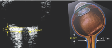 Click here to view Large Figure 9