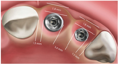 Click here to view Large Figure 1