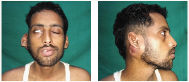 Click here to view Large image 1