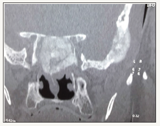 Click here to view Large image 1