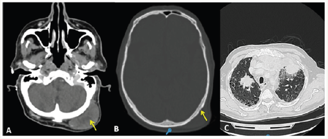 Click here to view Large image 1