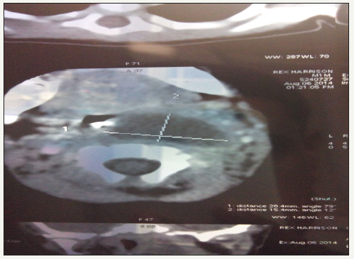 Click here to view Large image 2