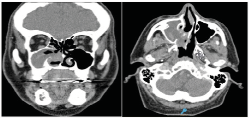 Click here to view Large image 1