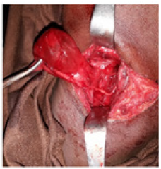 Click here to view Large image 4