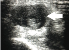 Click here to view Large Figure 1