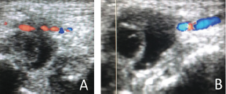 Click here to view Large Figure 3