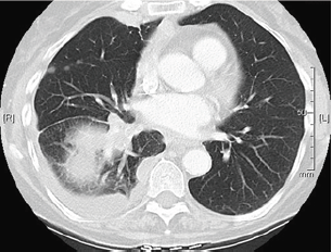 Click here to view Large Figure 1