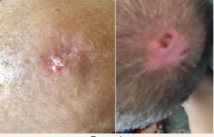 Click here to view Large Figure 1