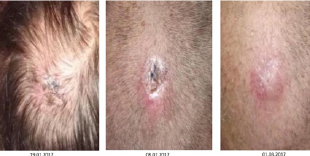 Click here to view Large Figure 2