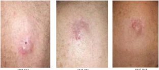 Click here to view Large Figure 3