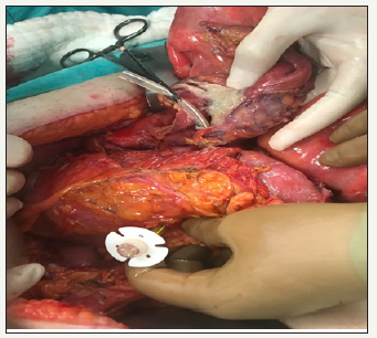 Click here to view Large image 2