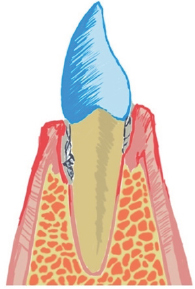 Click here to view Large Figure 1