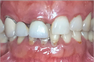 Click here to view Large Figure 2