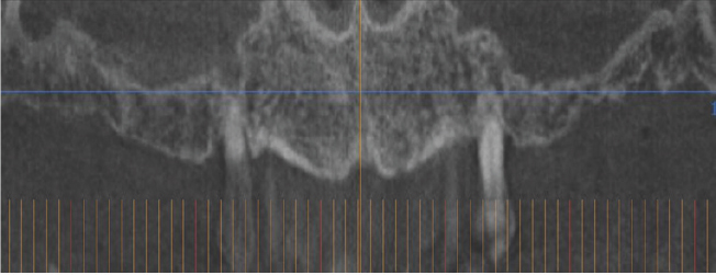 Click here to view Large Figure 2