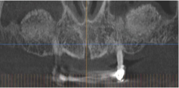 Click here to view Large Figure 2