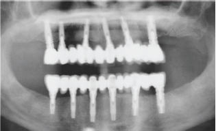 Click here to view Large Figure 2