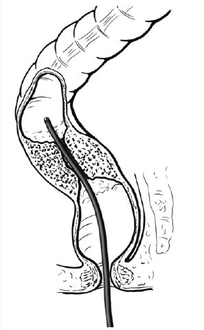 Click here to view Large Figure 1A