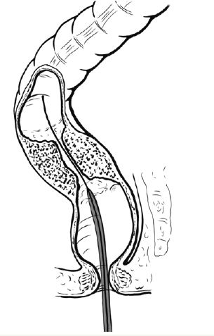 Click here to view Large Figure 1B