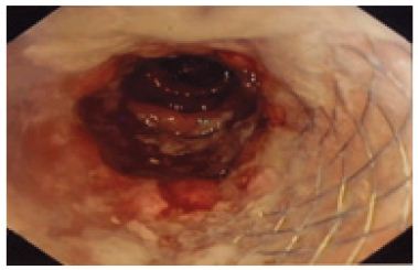 Click here to view Large Figure 2