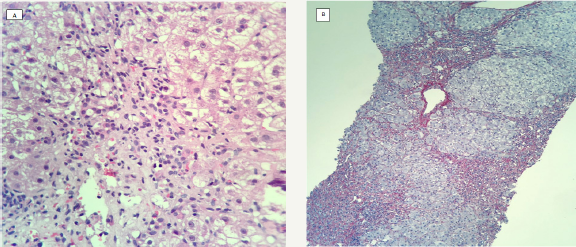Click here to view Large Figure 1
