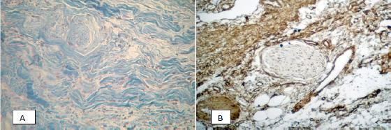 Click here to view Large Figure 4