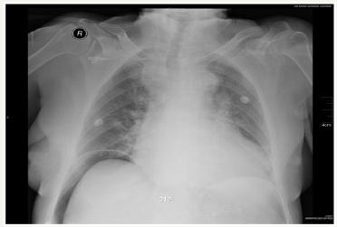 Click here to view Large image 1