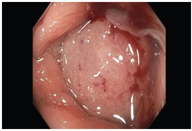 Click here to view Large image 1