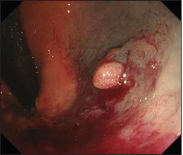 Click here to view Large image 1