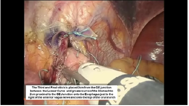 Click here to view Large image 13