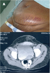 Click here to view Large Figure 1