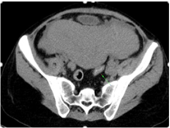 Click here to view Large image 2