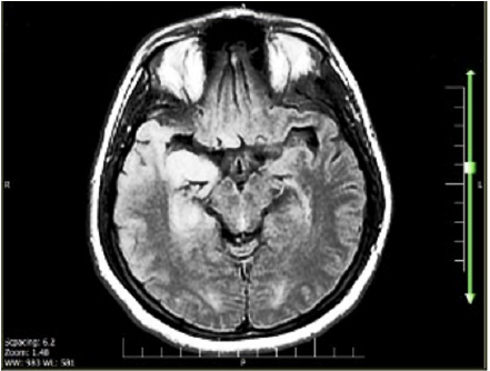 Click here to view Large image 1