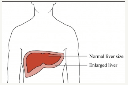 Click here to view Large image 1