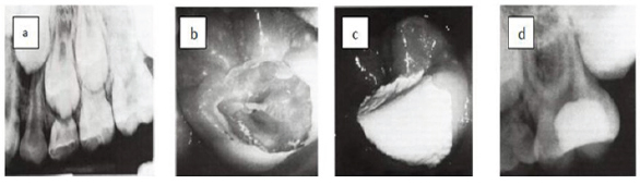 Click here to view Large Figure 1