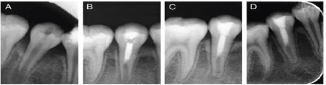 Click here to view Large Figure 2