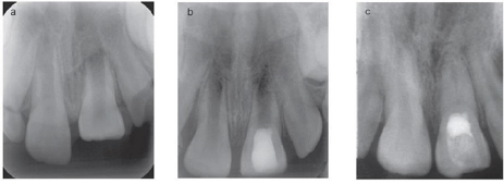 Click here to view Large Figure 4