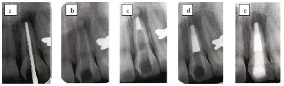 Click here to view Large Figure 8