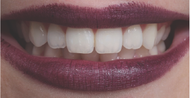 Click here to view Large Figure 10