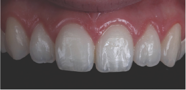 Click here to view Large Figure 11