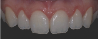 Click here to view Large Figure 13