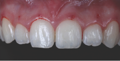 Click here to view Large Figure 4